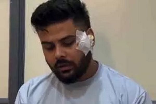 अंबिकापुर में छत्तीसगढ़ी कलाकार पर हमला