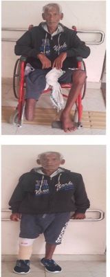 शासन की संवेदनशीलता का परिणाम: कृत्रिम पैर पाकर फिर चला आत्मविश्वास