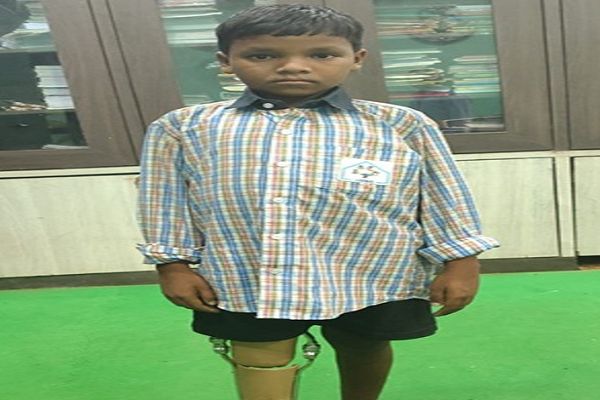 कमलेश को मिला कृत्रिम पैर,अब स्कूल जाने और आगे बढ़ने का बढ़ेगा आत्मविश्वास