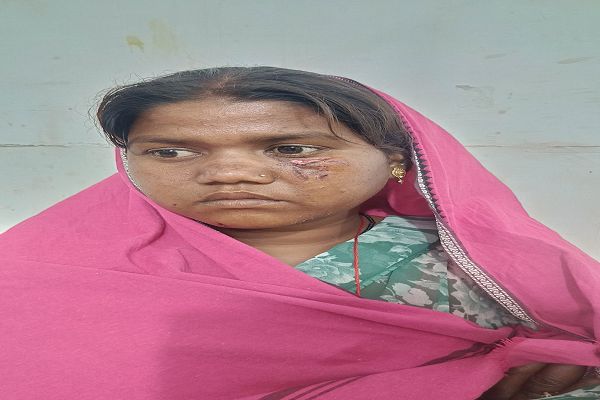  सुबह करीब 7:30 बजे हुई घटना, प्राथमिक उपचार के बाद अम्लीपदर से जिला चिकित्सालय भेजा गया; दोनों का इलाज जारी