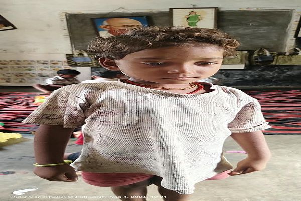  सेवा संकल्प अभियान : सेवा संकल्प से कुपोषण पर जीत, 16 सप्ताह में मिनाक्षी ने पाई सामान्य पोषण स्थिति
