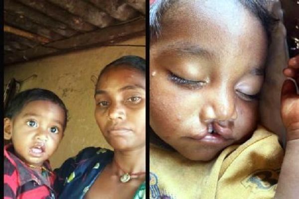 चिरायु योजना से बदली जिंदगी : नन्हे अभिषेक के चेहरे पर लौटी मुस्कान, अब सपनों की ओर बढ़ते कदम